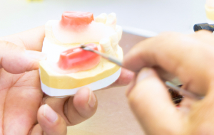 院内技工イメージ画像